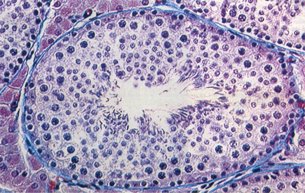 TESTICULE-detail.jpg