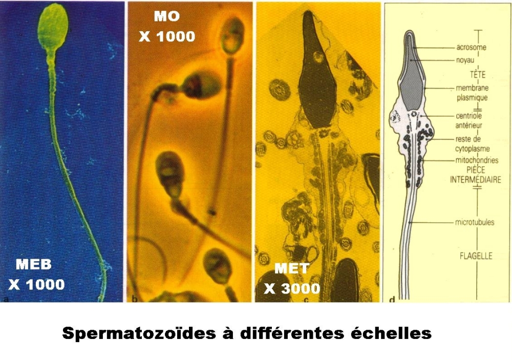 spermatozoide.jpg